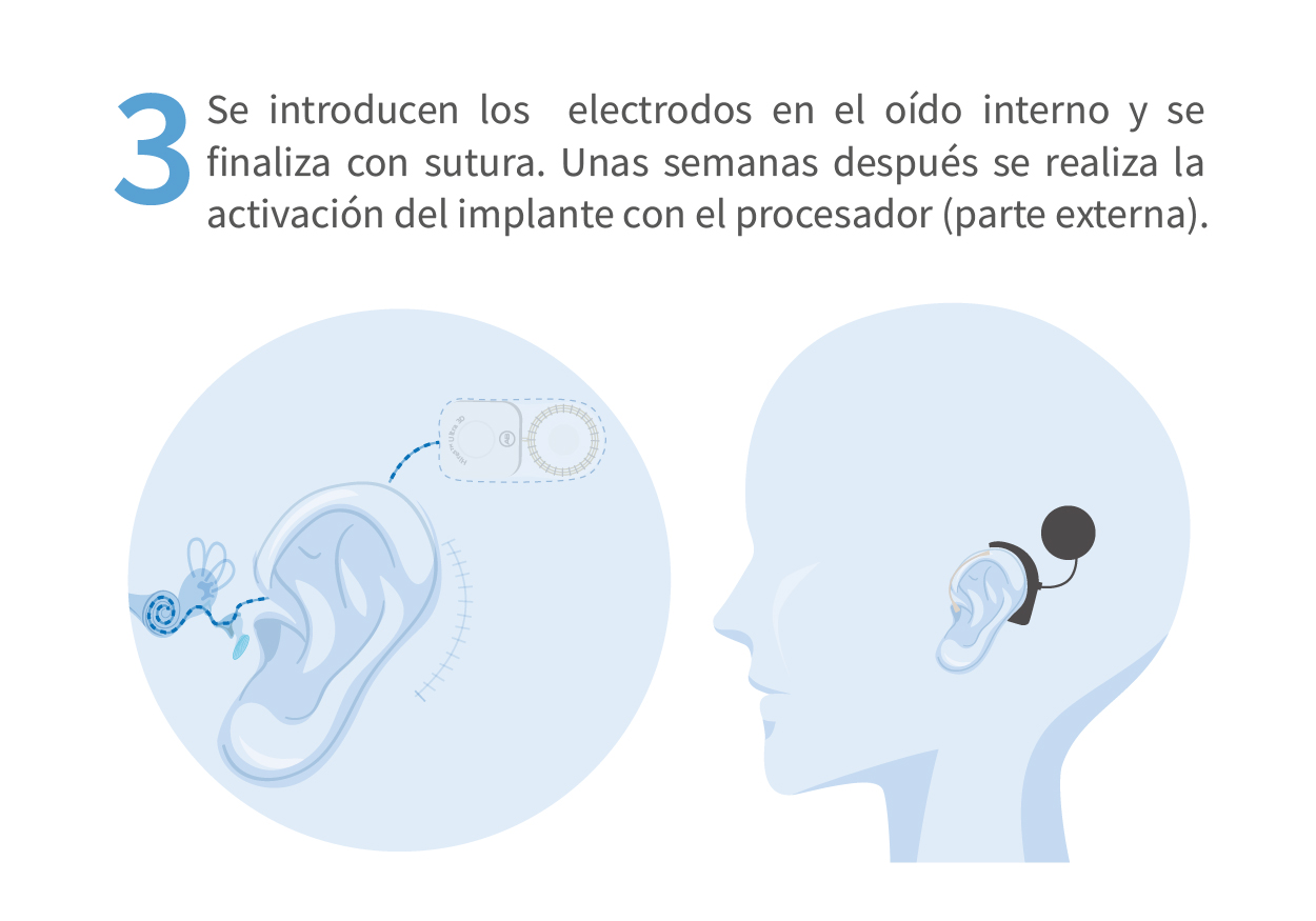CIRUGÍA3_Mesa de trabajo 1 copia 2