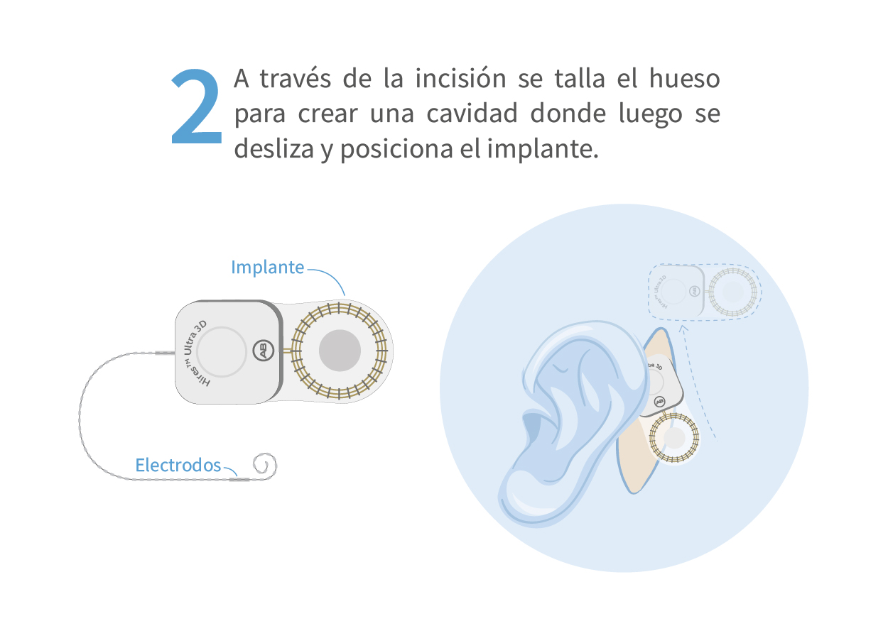 CIRUGÍA3_Mesa de trabajo 1 copia
