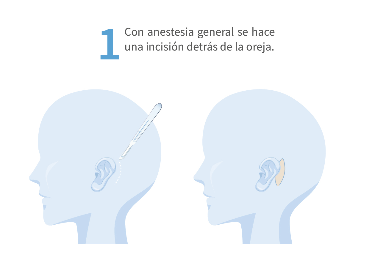 CIRUGÍA3_Mesa de trabajo 1